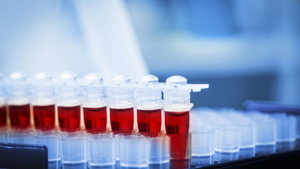 iStock_19592753_Blood Samples